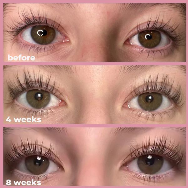 Skavix® Eyelash Serum – Eyelash Growth Serum 8ML for Thicker, Longer Lashes ✨ Developed by Anti-Aging Scientists 👩🔬 Clean Formula 🌱 No Prostaglandins 🚫