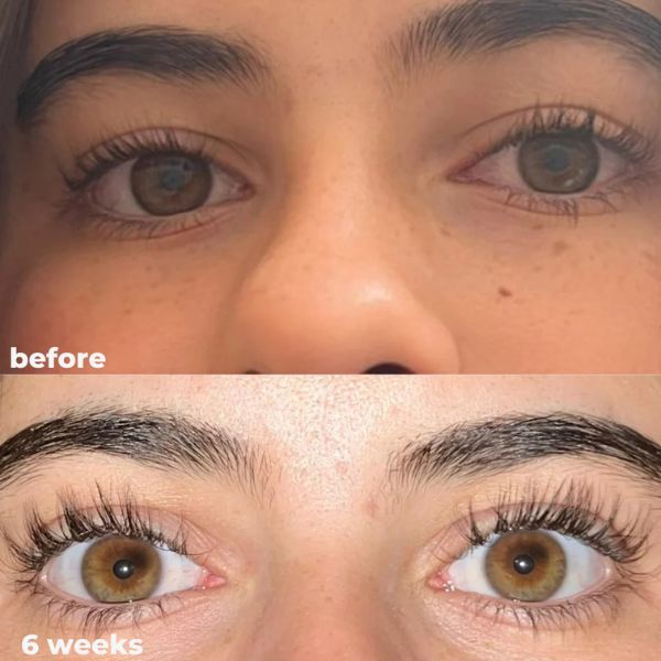Skavix® Eyelash Serum – Eyelash Growth Serum 8ML for Thicker, Longer Lashes ✨ Developed by Anti-Aging Scientists 👩🔬 Clean Formula 🌱 No Prostaglandins 🚫