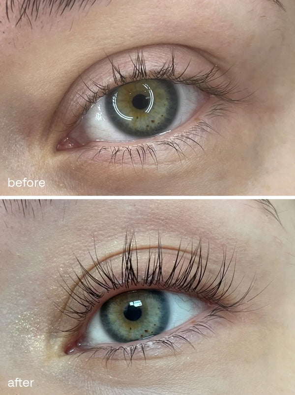 Skavix® Eyelash Serum – Eyelash Growth Serum 8ML for Thicker, Longer Lashes ✨ Developed by Anti-Aging Scientists 👩🔬 Clean Formula 🌱 No Prostaglandins 🚫