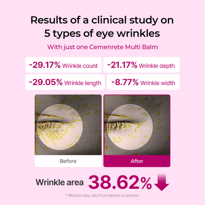🌟[Dr.Meloxin Official] 70%OFF✨Cemenrete Calcium Multi Balm | Anti-aging, Sagging, Wrinkles | Korean Cosmetics💖